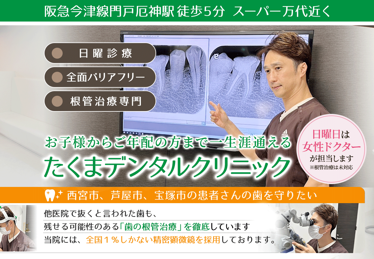 根管治療 - 西宮市伏原町の歯科医院 たくまデンタルクリニック